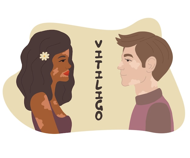 A couple of a guy and a girl with vitiligo. Vector illustration in a flat style. Depigmentation of the skin.