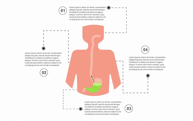 Creative Infographic template for sign to GERD Stomach diseases with 4 option