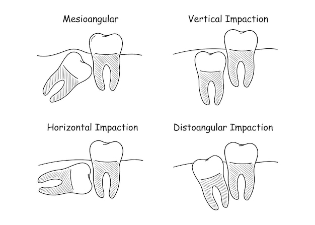 Dental anatomy set teeth growth set of vector illustrations in doodle style