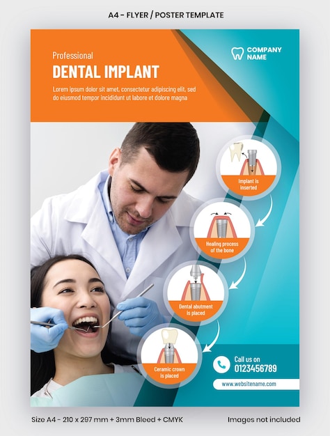 Dental Implant Service Flyer or Poster Template