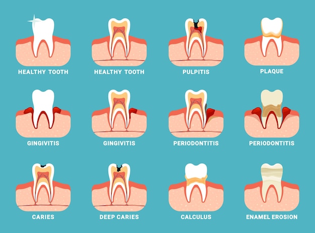 Dental problems different teeth damaged oral bad breath dental care information Vector flat templates