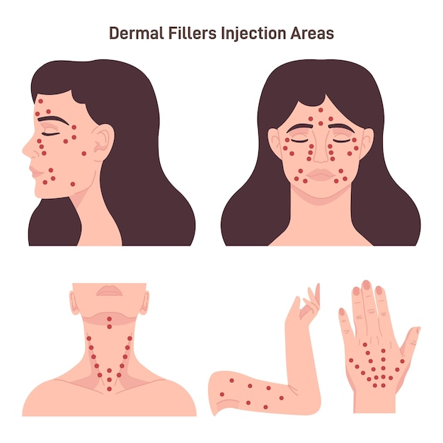 Vector dermal filler injections sites woman face neck amd hands with hilighted