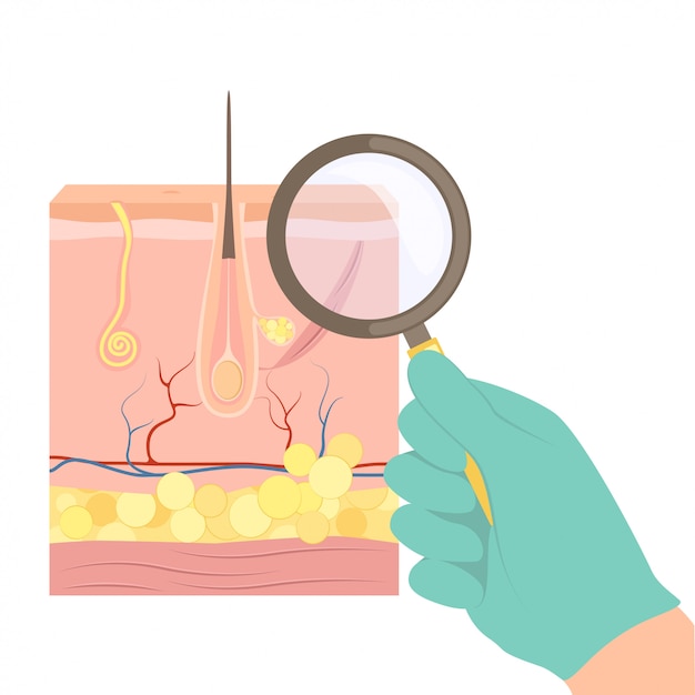 A dermatologist with a magnifying glass examines the skin of the patient.