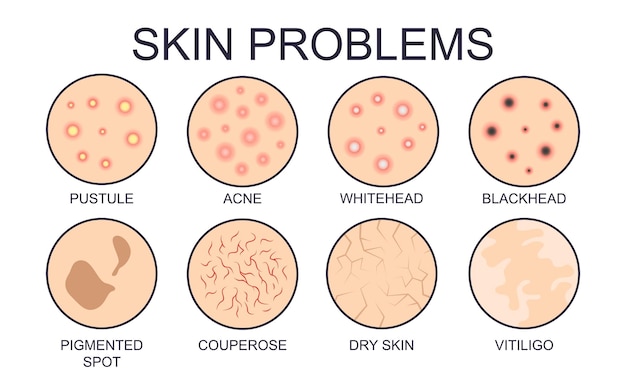 Different types of skin problems vector illustrations set