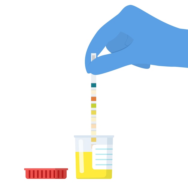 The doctor uses a urine test strip