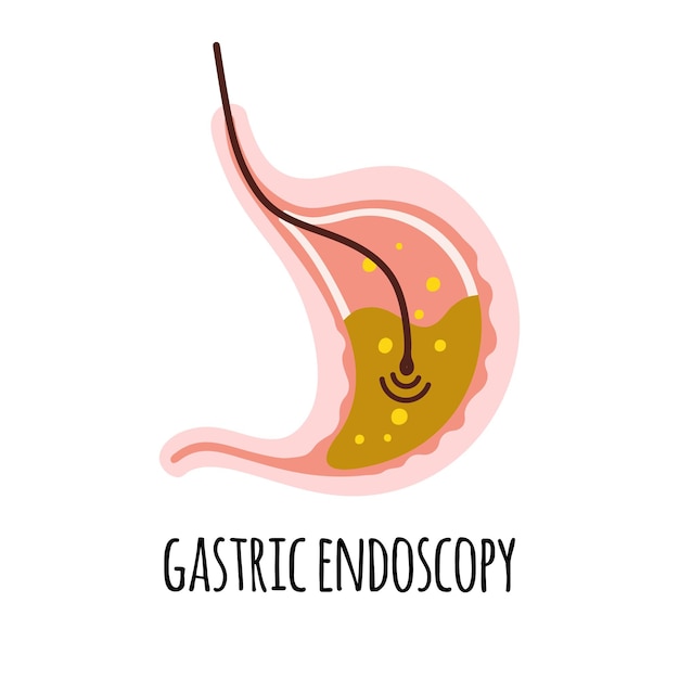 Endoscopy The stomach of a person with high acidity Gastroenterology