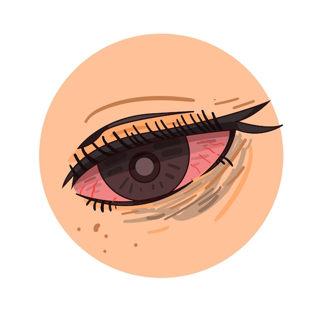 Eye illustration