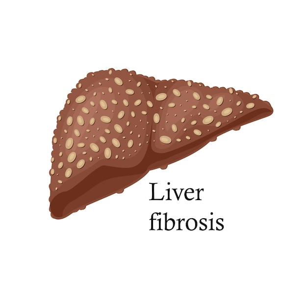 Fibrosis liver on white background cartoon illustration