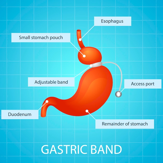 Gastric band icon. Vector illustration