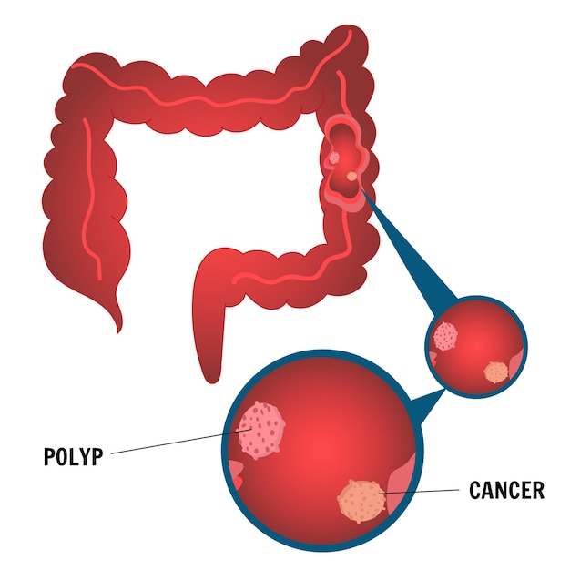 Gastroenterology gut to dissolve the capsule in vector illustration