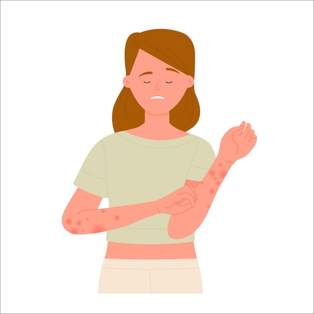 Vector girl scratching hands covered with red rash