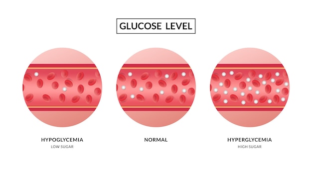 Glucose in the blood vessel Hypoglycemia and Hyperglycemia