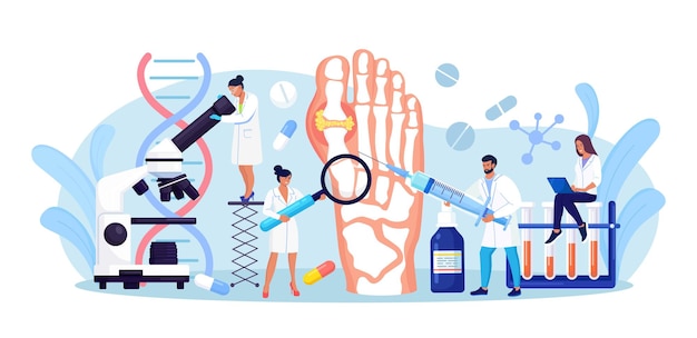 Gout treatment. Arthritis joint in the ankle. Doctor diagnoses swollen and inflamed foot joint. Physician examination human feet bone with uric acid crystals. Medical appointment and exam