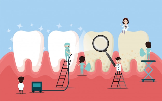 Group of small dentists are caring for a large tooth. Dental personage vector illustration.