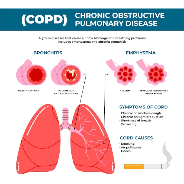 Hand drawn copd infographic