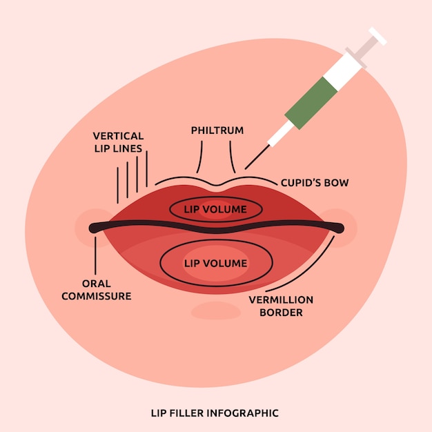 Hand drawn flat design lip filler illustration