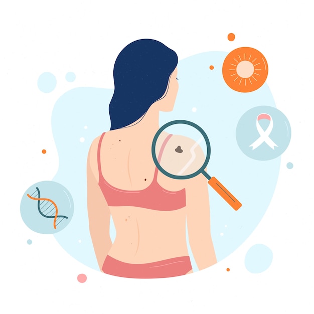 Vector hand drawn flat design melanoma illustration