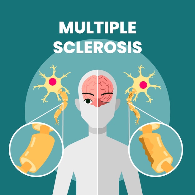 Hand drawn flat design multiple sclerosis illustration