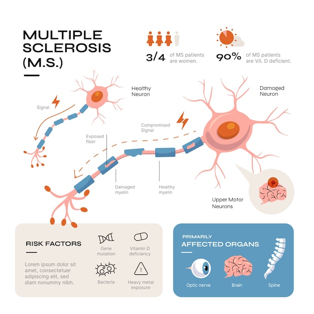 Hand drawn flat design multiple sclerosis infographic