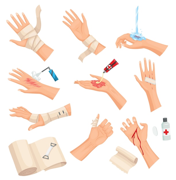 Hands injured skin and procedures of bandaging and wound cleaning First aid for wound Medicine cure or treatment First emergency help for human hand trauma