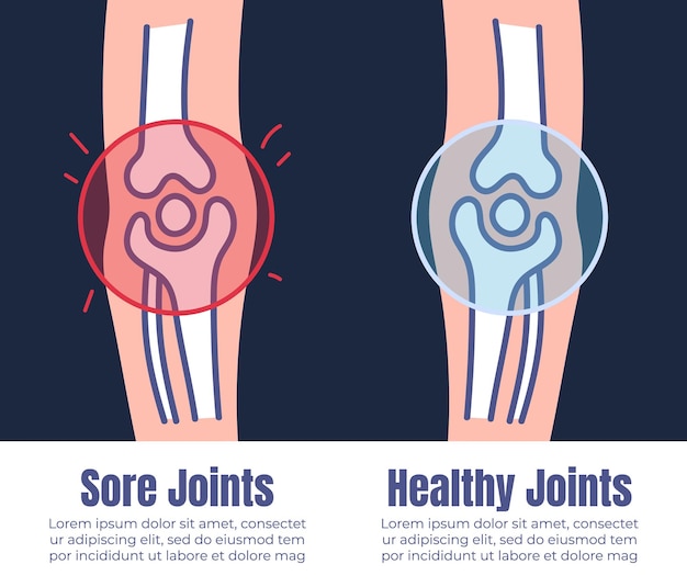 Healthy and injury joint muscle x ray concept graphic design illustration