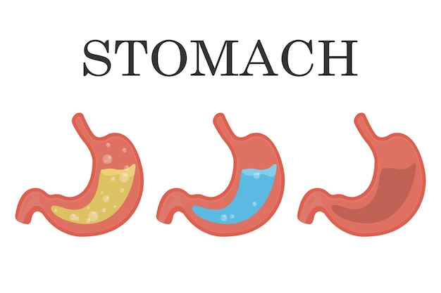 Healthy and unhealthy empty and full human stomach gastric juice reflux Nutrition stomach pain