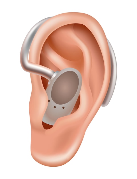 Hearing aid Sound amplifier for patients with hearing loss Medicine and health Realistic object behind the ear Treatment and prosthetics in otolaryngology