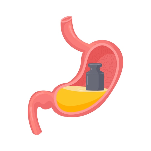 Heaviness in stomach Isolated vector illustration Gases problem gastritis design element