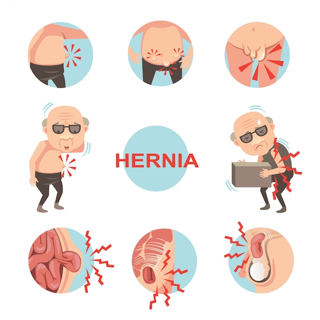 Hernia In circle set.