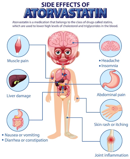 Human anatomy diagram cartoon style of Atorvastatin side effects