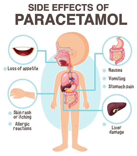 Human anatomy diagram cartoon style of paracetamol side effects