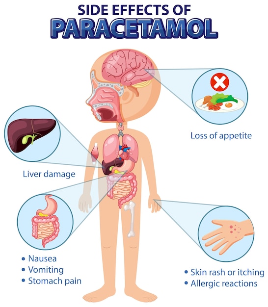 Human anatomy diagram cartoon style of paracetamol side effects