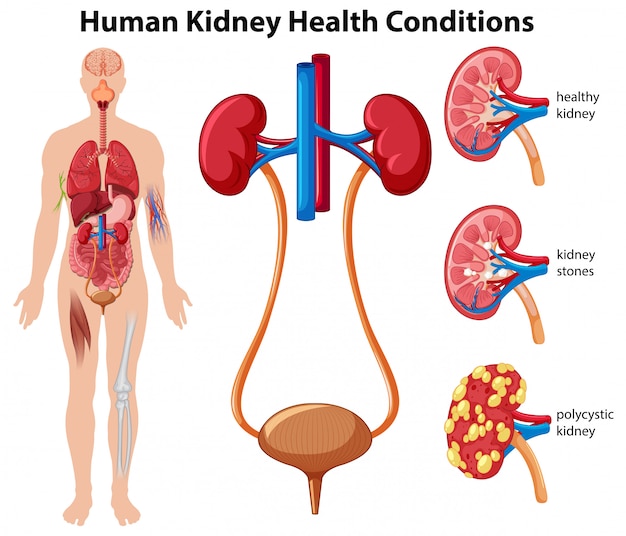 Vector human kidney health conditions