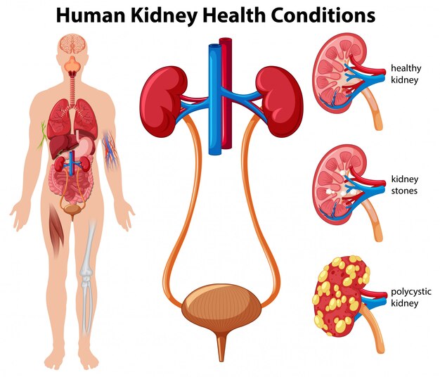 Vector human kidney health conditions