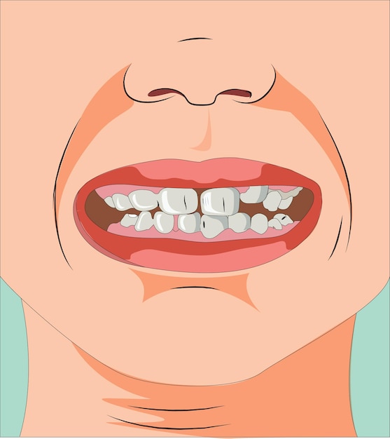 Human mouth illustration showing teeth and nose