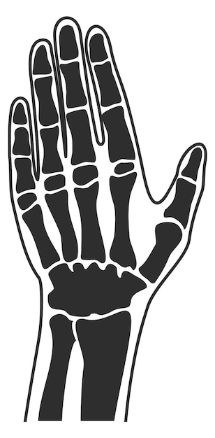 Human palm xray Hand bones anatomy illustration