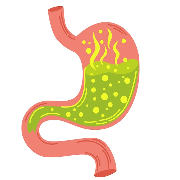 Human stomach Gastritis and acid reflux indigestion vomiting heartburn and stomach pain problems Unhealthy stomach concept Heartburn illness discomfort pain Flat vector illustration