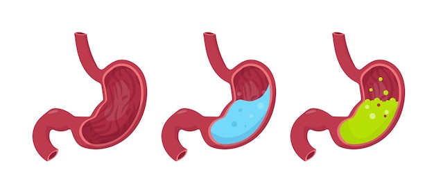 Human stomach set Empty stomach stomach with water and with green liquid