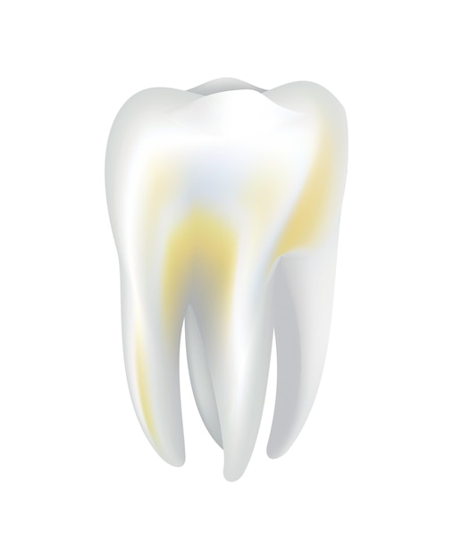 Illnessed human tooth. Dental medical vector icon. Need dental care for stained teeth or tooth caries. Oral teeth restoration