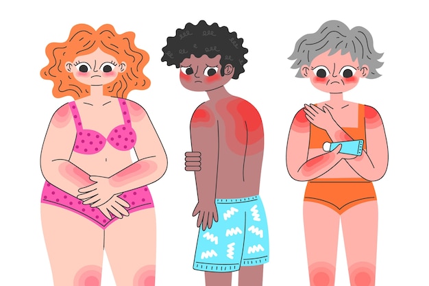 Vector illustrated flat people with a sunburn