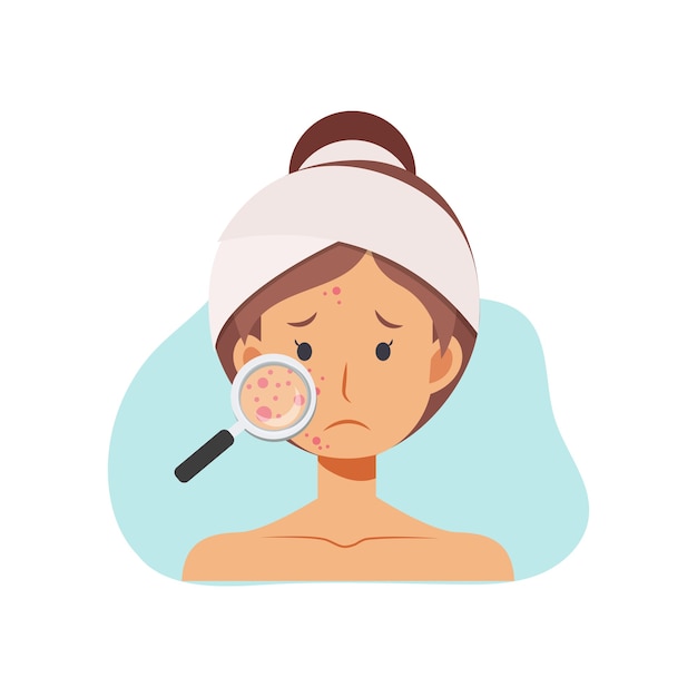  illustration about Acne skin problems Concept.  woman with magnifying glass is looking acne on her facial. 
