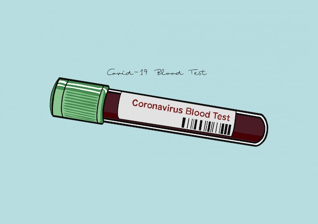 Illustration of Coronavirus / COVID-19 Blood Test