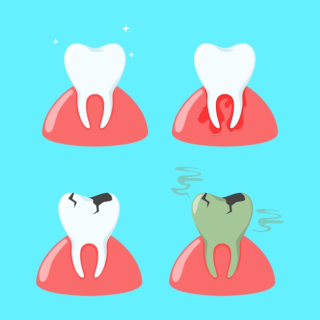 illustration design of collection of teeth and toothache