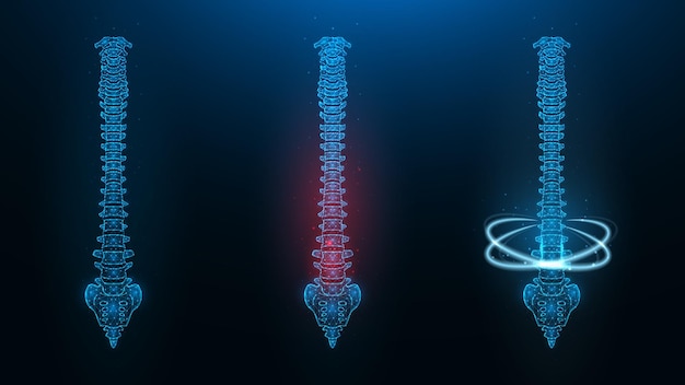 Vector illustration of a healthy sick and recovering spine