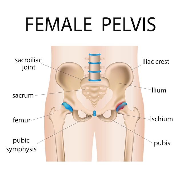 illustration of painful hip sacral inflammation hip pain bursitis arthritis