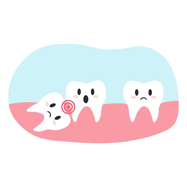 Impacted wisdom tooth in cartoon flat style Vector illustration of disgruntled teeth characters dental health concept oral hygiene