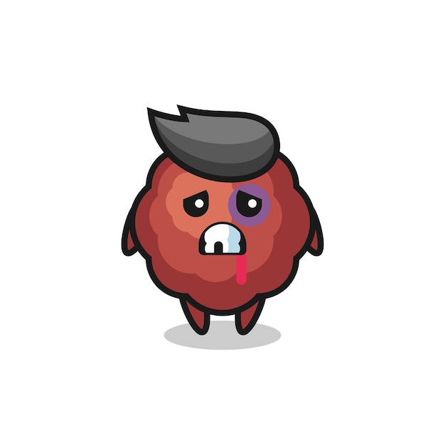 Injured meatball character with a bruised face