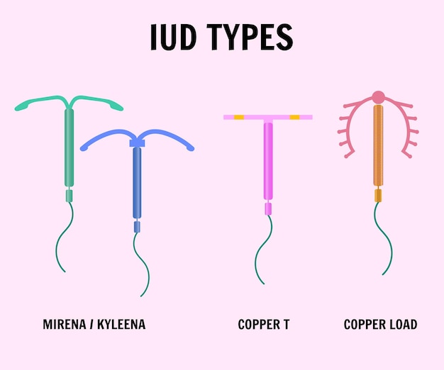 Intrauterine device types in vector