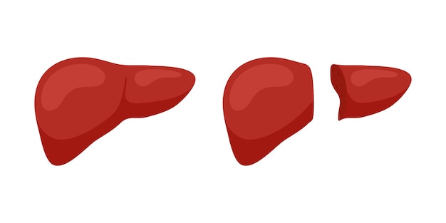 Living donor right lobe liver transplantation concept. Human exocrine gland organ transplant operation concept. Vector flat illustration