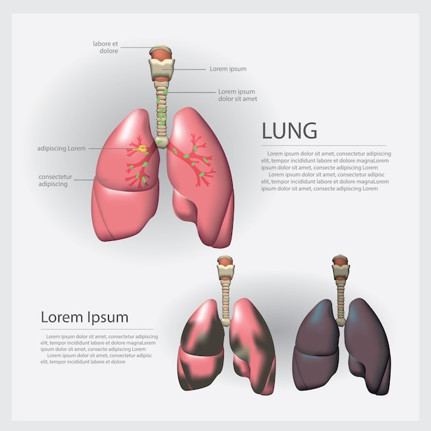 Lung with Detail and Lung Cancer Vector Illustration